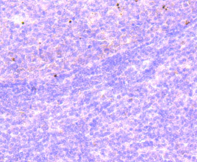 Immunohistochemical analysis of paraffin-embedded human tonsil tissue using anti-Histone H2B(mono methyl R79) antibody. Counter stained with hematoxylin.