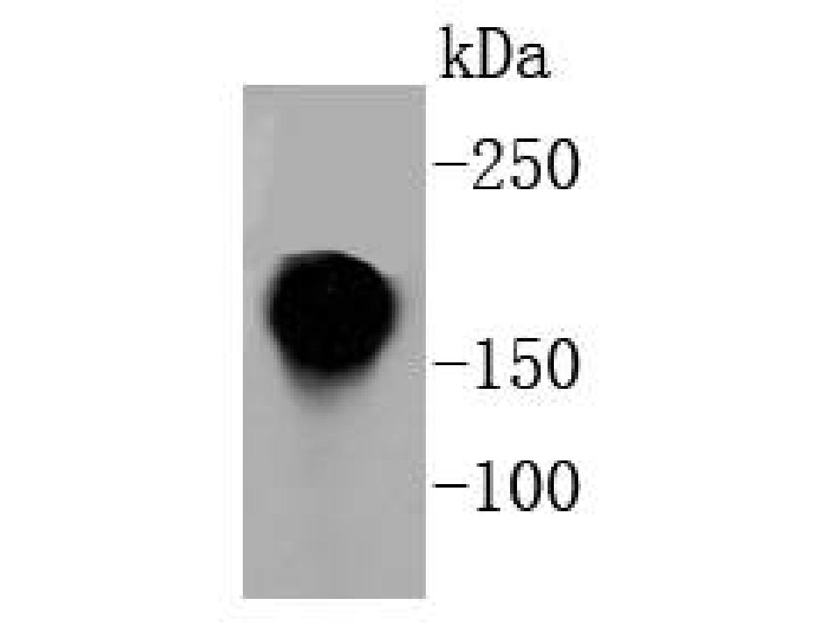 Western blot analysis of CD11a on Jurkat cell lysates. Proteins were transferred to a PVDF membrane and blocked with 5% BSA in PBS for 1 hour at room temperature. The primary antibody (ET1610-1, 1/500) was used in 5% BSA at room temperature for 2 hours. Goat Anti-Rabbit IgG - HRP Secondary Antibody (HA1001) at 1:200,000 dilution was used for 1 hour at room temperature.