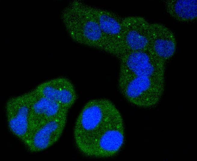 ICC staining of CD11a in Hela cells (green). Formalin fixed cells were permeabilized with 0.1% Triton X-100 in TBS for 10 minutes at room temperature and blocked with 10% negative goat serum for 15 minutes at room temperature. Cells were probed with the primary antibody (ET1610-1, 1/50) for 1 hour at room temperature, washed with PBS. Alexa Fluor®488 conjugate-Goat anti-Rabbit IgG was used as the secondary antibody at 1/1,000 dilution. The nuclear counter stain is DAPI (blue).