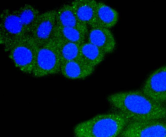 ICC staining of CD11a in HepG2 cells (green). Formalin fixed cells were permeabilized with 0.1% Triton X-100 in TBS for 10 minutes at room temperature and blocked with 10% negative goat serum for 15 minutes at room temperature. Cells were probed with the primary antibody (ET1610-1, 1/50) for 1 hour at room temperature, washed with PBS. Alexa Fluor®488 conjugate-Goat anti-Rabbit IgG was used as the secondary antibody at 1/1,000 dilution. The nuclear counter stain is DAPI (blue).
