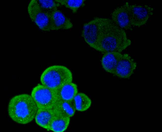 ICC staining of CD11a in SW480 cells (green). Formalin fixed cells were permeabilized with 0.1% Triton X-100 in TBS for 10 minutes at room temperature and blocked with 10% negative goat serum for 15 minutes at room temperature. Cells were probed with the primary antibody (ET1610-1, 1/50) for 1 hour at room temperature, washed with PBS. Alexa Fluor®488 conjugate-Goat anti-Rabbit IgG was used as the secondary antibody at 1/1,000 dilution. The nuclear counter stain is DAPI (blue).