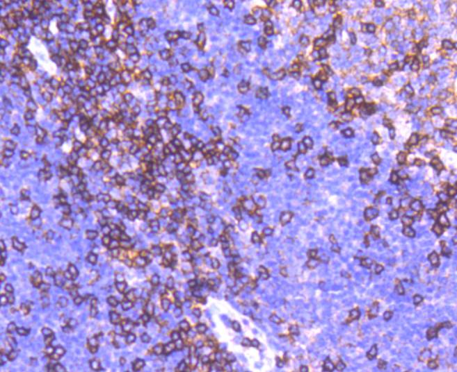 Immunohistochemical analysis of paraffin-embedded human tonsil tissue using anti-CD11a antibody. The section was pre-treated using heat mediated antigen retrieval with Tris-EDTA buffer (pH 9.0) for 20 minutes.The tissues were blocked in 1% BSA for 30 minutes at room temperature, washed with ddH2O and PBS, and then probed with the primary antibody (ET1610-1, 1/50) for 30 minutes at room temperature. The detection was performed using an HRP conjugated compact polymer system. DAB was used as the chromogen. Tissues were counterstained with hematoxylin and mounted with DPX.