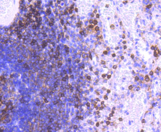 Immunohistochemical analysis of paraffin-embedded human spleen tissue using anti-CD11a antibody. The section was pre-treated using heat mediated antigen retrieval with Tris-EDTA buffer (pH 9.0) for 20 minutes.The tissues were blocked in 1% BSA for 30 minutes at room temperature, washed with ddH2O and PBS, and then probed with the primary antibody (ET1610-1, 1/50) for 30 minutes at room temperature. The detection was performed using an HRP conjugated compact polymer system. DAB was used as the chromogen. Tissues were counterstained with hematoxylin and mounted with DPX.
