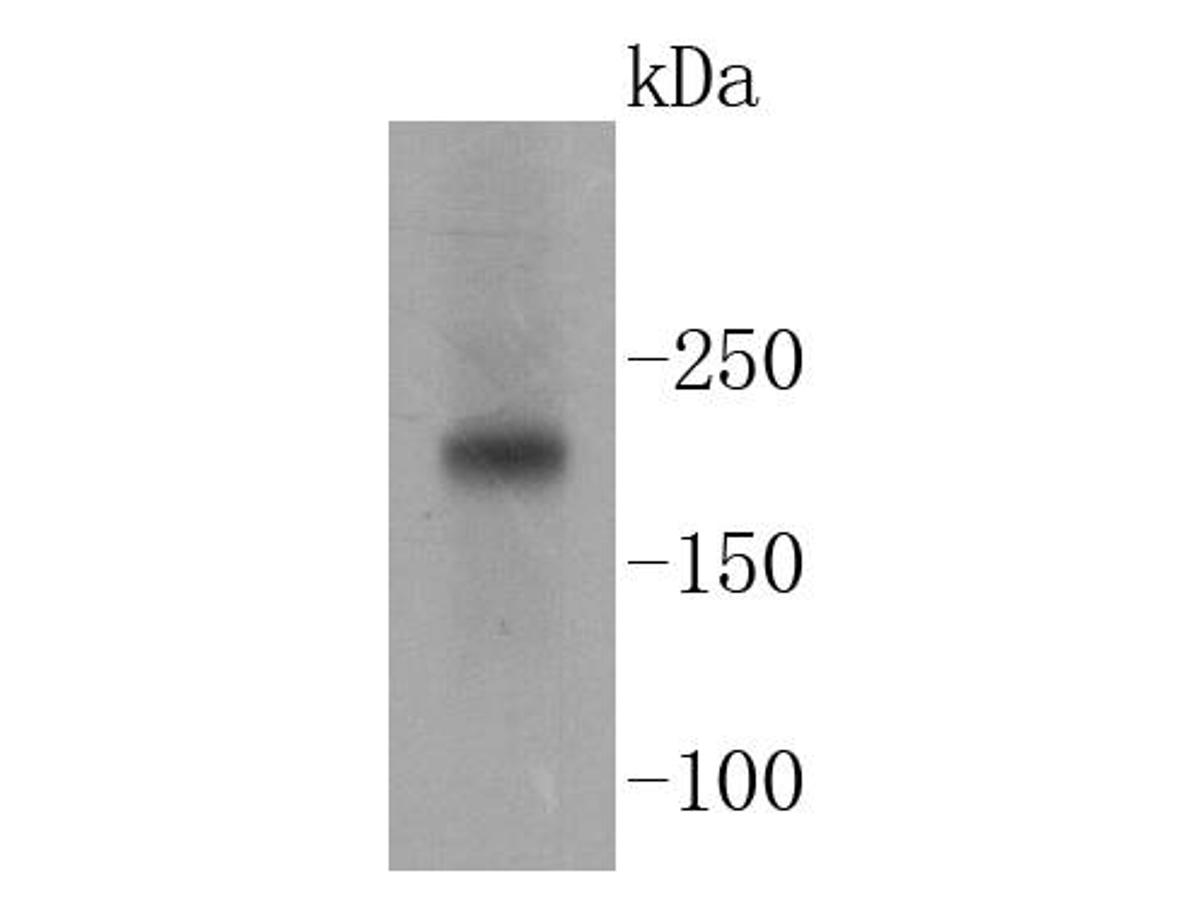 Western blot analysis of Tuberin on Jurkat cell lysates. Proteins were transferred to a PVDF membrane and blocked with 5% BSA in PBS for 1 hour at room temperature. The primary antibody (ET1610-10, 1/500) was used in 5% BSA at room temperature for 2 hours. Goat Anti-Rabbit IgG - HRP Secondary Antibody (HA1001) at 1:5,000 dilution was used for 1 hour at room temperature.