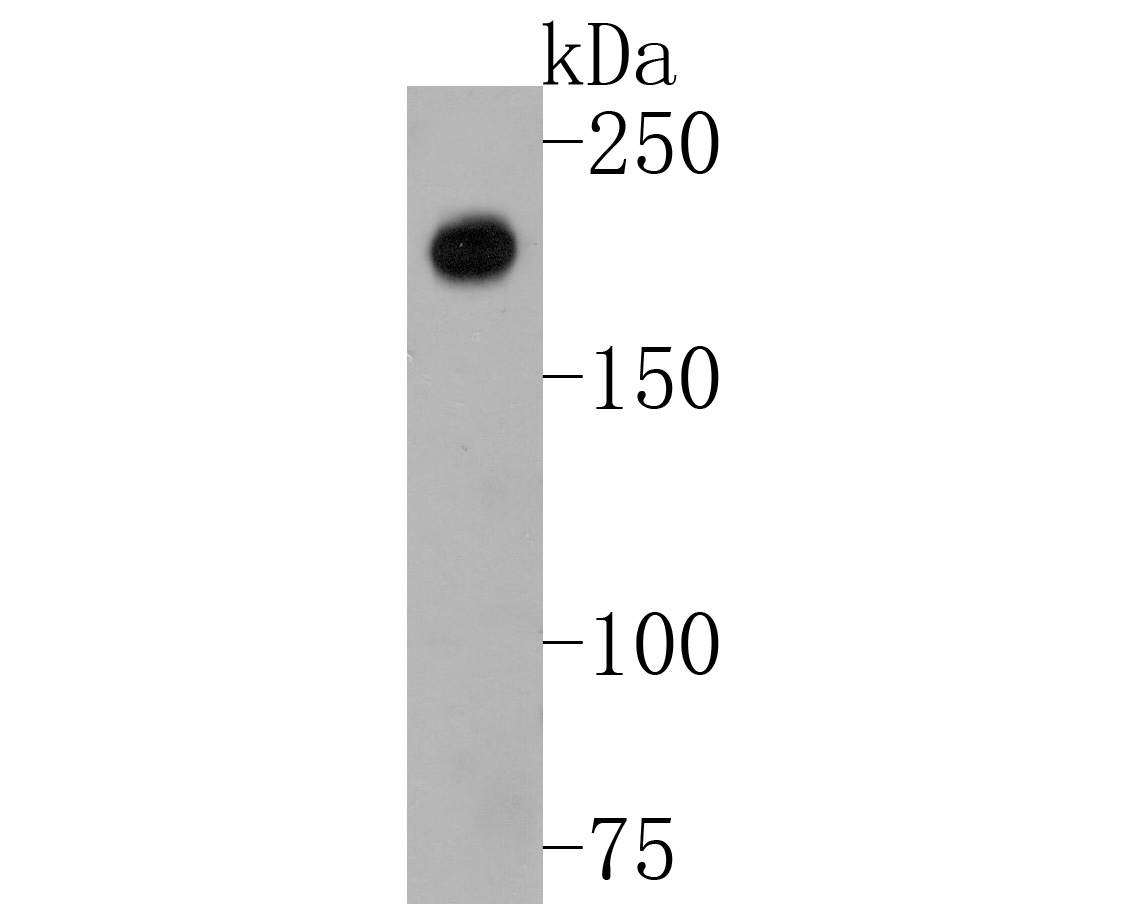Western blot analysis of Tuberin on MCF-7 cell lysates. Proteins were transferred to a PVDF membrane and blocked with 5% BSA in PBS for 1 hour at room temperature. The primary antibody (ET1610-10, 1/500) was used in 5% BSA at room temperature for 2 hours. Goat Anti-Rabbit IgG - HRP Secondary Antibody (HA1001) at 1:5,000 dilution was used for 1 hour at room temperature.