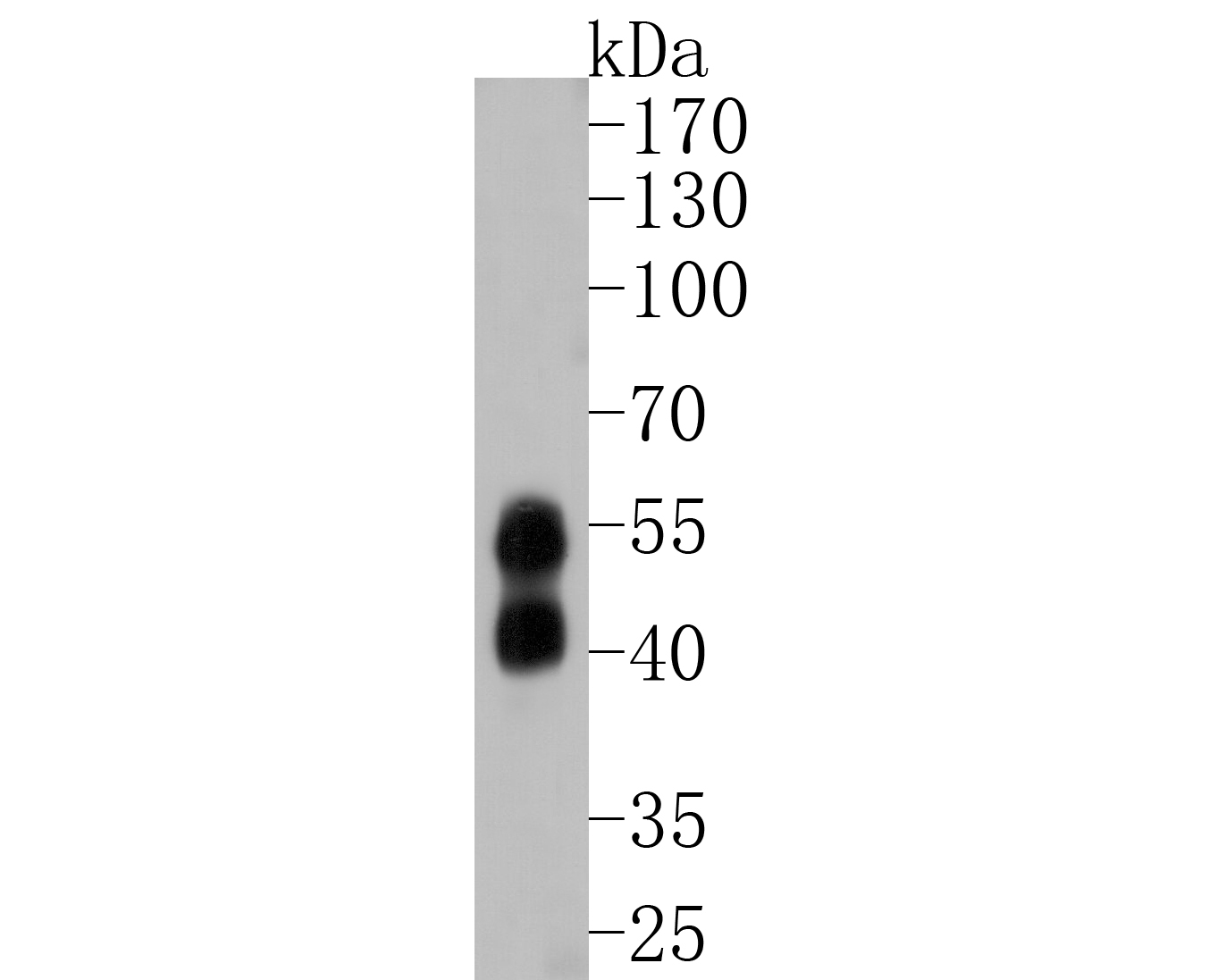 Western blot analysis of JNK2 on SHG-44 cell lysates. Proteins were transferred to a PVDF membrane and blocked with 5% BSA in PBS for 1 hour at room temperature. The primary antibody (ET1610-11, 1/500) was used in 5% BSA at room temperature for 2 hours. Goat Anti-Rabbit IgG - HRP Secondary Antibody (HA1001) at 1:5,000 dilution was used for 1 hour at room temperature.
