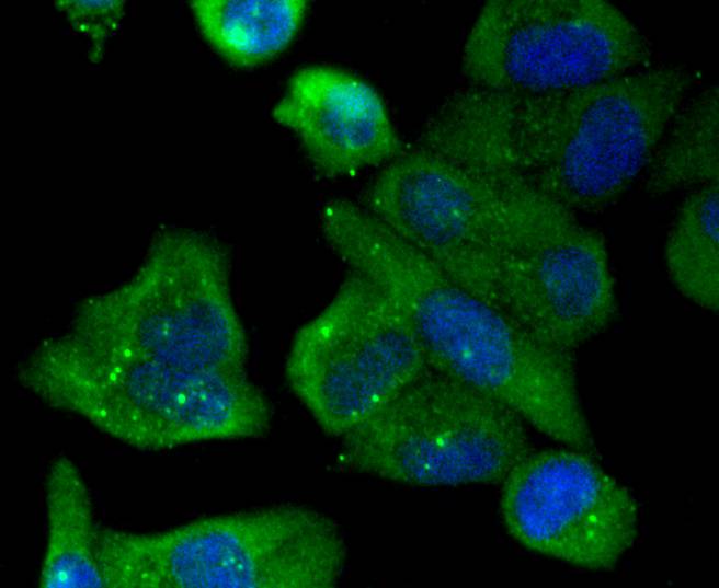 ICC staining of JNK2 in Hela cells (green). Formalin fixed cells were permeabilized with 0.1% Triton X-100 in TBS for 10 minutes at room temperature and blocked with 1% Blocker BSA for 15 minutes at room temperature. Cells were probed with the primary antibody (ET1610-11, 1/50) for 1 hour at room temperature, washed with PBS. Alexa Fluor®488 Goat anti-Rabbit IgG was used as the secondary antibody at 1/1,000 dilution. The nuclear counter stain is DAPI (blue).