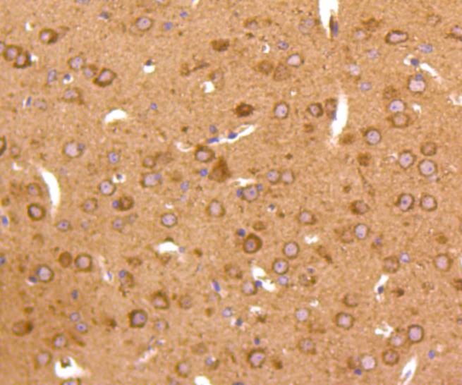 Immunohistochemical analysis of paraffin-embedded mouse brain tissue using anti-JNK2 antibody. The section was pre-treated using heat mediated antigen retrieval with Tris-EDTA buffer (pH 8.0-8.4) for 20 minutes.The tissues were blocked in 5% BSA for 30 minutes at room temperature, washed with ddH2O and PBS, and then probed with the primary antibody (ET1610-11, 1/50) for 30 minutes at room temperature. The detection was performed using an HRP conjugated compact polymer system. DAB was used as the chromogen. Tissues were counterstained with hematoxylin and mounted with DPX.