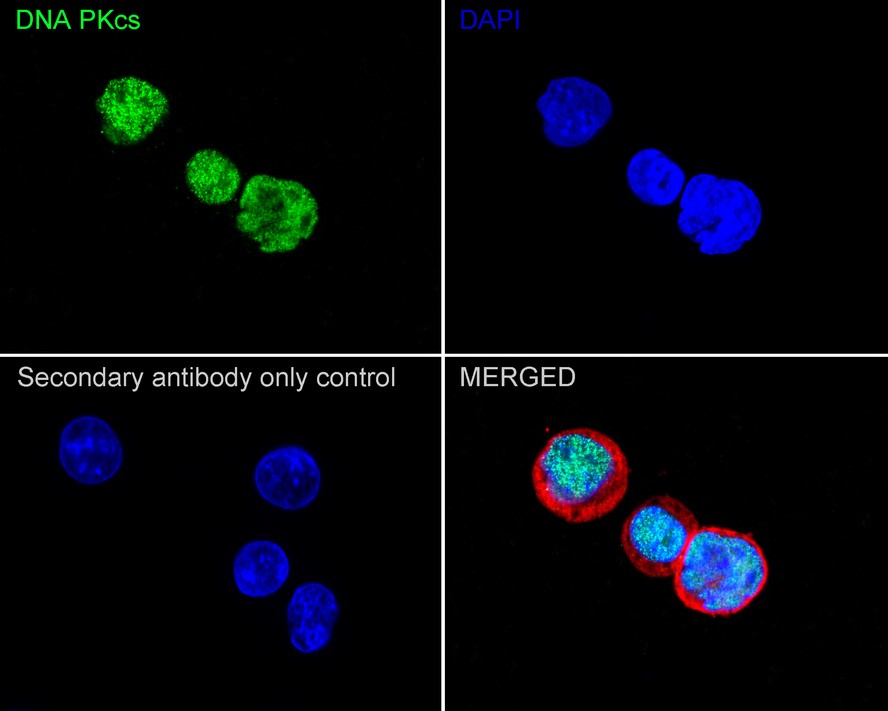 ICC staining of DNA PKcs in Hela cells (green). Formalin fixed cells were permeabilized with 0.1% Triton X-100 in TBS for 10 minutes at room temperature and blocked with 1% Blocker BSA for 15 minutes at room temperature. Cells were probed with the primary antibody (ET1610-12, 1/50) for 1 hour at room temperature, washed with PBS. Alexa Fluor®488 Goat anti-Rabbit IgG was used as the secondary antibody at 1/1,000 dilution. The nuclear counter stain is DAPI (blue).