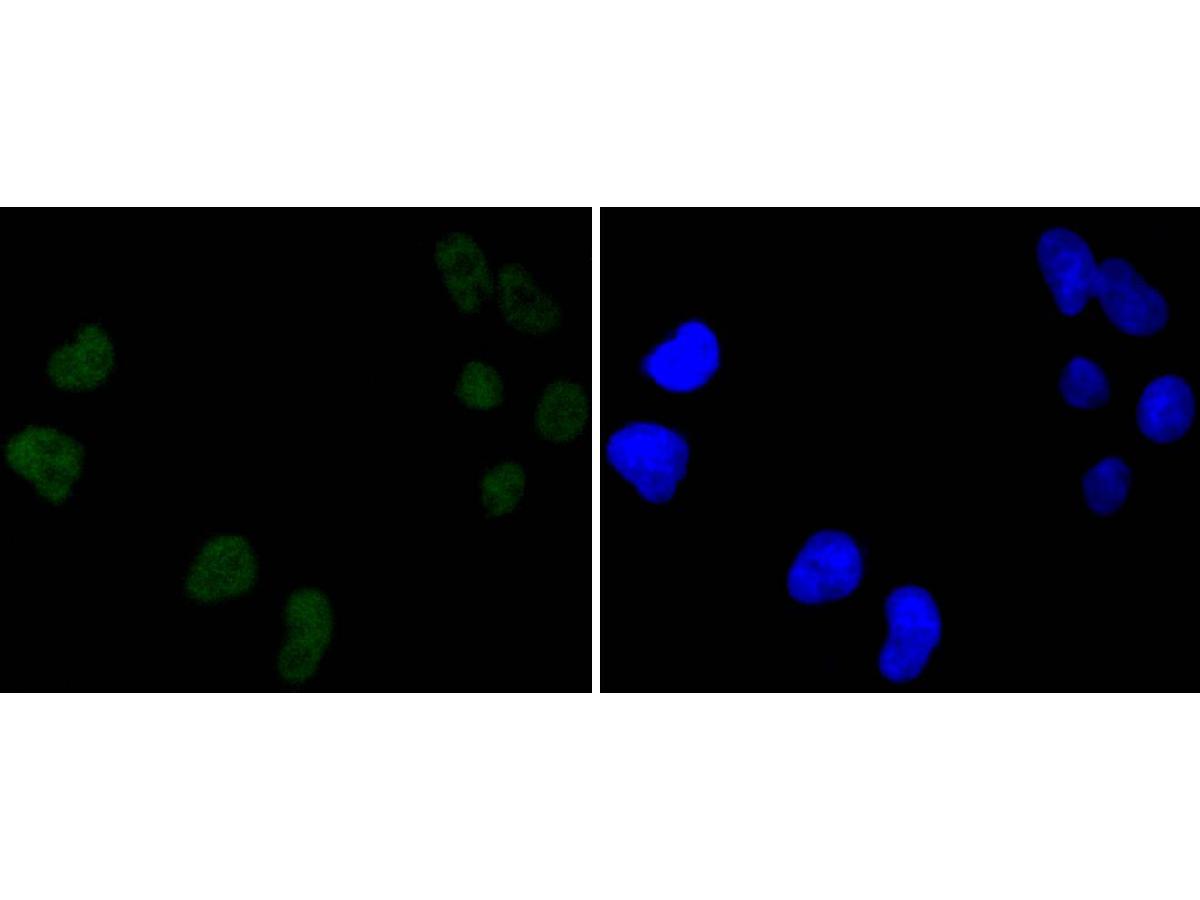 ICC staining of DNA PKcs in MCF-7 cells (green). Formalin fixed cells were permeabilized with 0.1% Triton X-100 in TBS for 10 minutes at room temperature and blocked with 1% Blocker BSA for 15 minutes at room temperature. Cells were probed with the primary antibody (ET1610-12, 1/50) for 1 hour at room temperature, washed with PBS. Alexa Fluor®488 Goat anti-Rabbit IgG was used as the secondary antibody at 1/1,000 dilution. The nuclear counter stain is DAPI (blue).