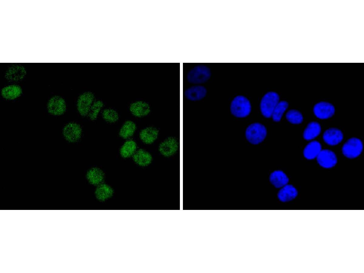 ICC staining of DNA PKcs in A549 cells (green). Formalin fixed cells were permeabilized with 0.1% Triton X-100 in TBS for 10 minutes at room temperature and blocked with 1% Blocker BSA for 15 minutes at room temperature. Cells were probed with the primary antibody (ET1610-12, 1/50) for 1 hour at room temperature, washed with PBS. Alexa Fluor®488 Goat anti-Rabbit IgG was used as the secondary antibody at 1/1,000 dilution. The nuclear counter stain is DAPI (blue).
