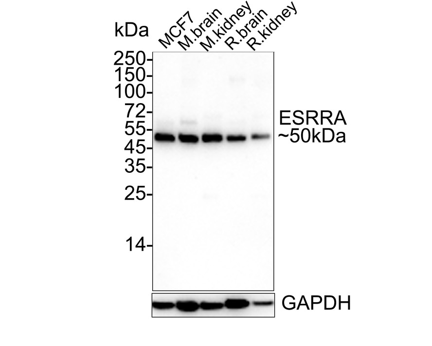 Western blot analysis of Estrogen Related Receptor alpha on different lysates with Rabbit anti-Estrogen Related Receptor alpha antibody (ET1610-14) at 1/500 dilution.<br />
<br />
Lane 1: MCF-7 cell lysate<br />
Lane 2: SK-Br-3 cell lysate<br />
Lane 3: PC-3 cell lysate<br />
<br />
Lysates/proteins at 10 µg/Lane.<br />
<br />
Predicted band size: 46 kDa<br />
Observed band size: 50 kDa<br />
<br />
Exposure time: 2 minutes;<br />
<br />
10% SDS-PAGE gel.<br />
<br />
Proteins were transferred to a PVDF membrane and blocked with 5% NFDM/TBST for 1 hour at room temperature. The primary antibody (ET1610-14) at 1/500 dilution was used in 5% NFDM/TBST at room temperature for 2 hours. Goat Anti-Rabbit IgG - HRP Secondary Antibody (HA1001) at 1:200,000 dilution was used for 1 hour at room temperature.