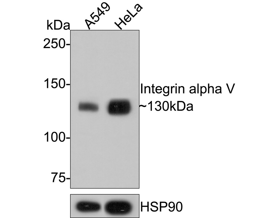 ICC staining of Integrin alpha V in SiHa cells (green). Formalin fixed cells were permeabilized with 0.1% Triton X-100 in TBS for 10 minutes at room temperature and blocked with 1% Blocker BSA for 15 minutes at room temperature. Cells were probed with the primary antibody (ET1610-15, 1/50) for 1 hour at room temperature, washed with PBS. Alexa Fluor®488 Goat anti-Rabbit IgG was used as the secondary antibody at 1/1,000 dilution. The nuclear counter stain is DAPI (blue).