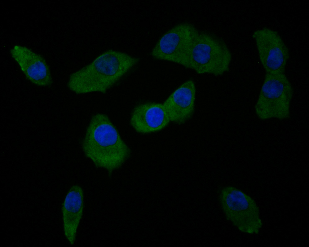 ICC staining of Integrin alpha V in A549 cells (green). Formalin fixed cells were permeabilized with 0.1% Triton X-100 in TBS for 10 minutes at room temperature and blocked with 1% Blocker BSA for 15 minutes at room temperature. Cells were probed with the primary antibody (ET1610-15, 1/50) for 1 hour at room temperature, washed with PBS. Alexa Fluor®488 Goat anti-Rabbit IgG was used as the secondary antibody at 1/1,000 dilution. The nuclear counter stain is DAPI (blue).