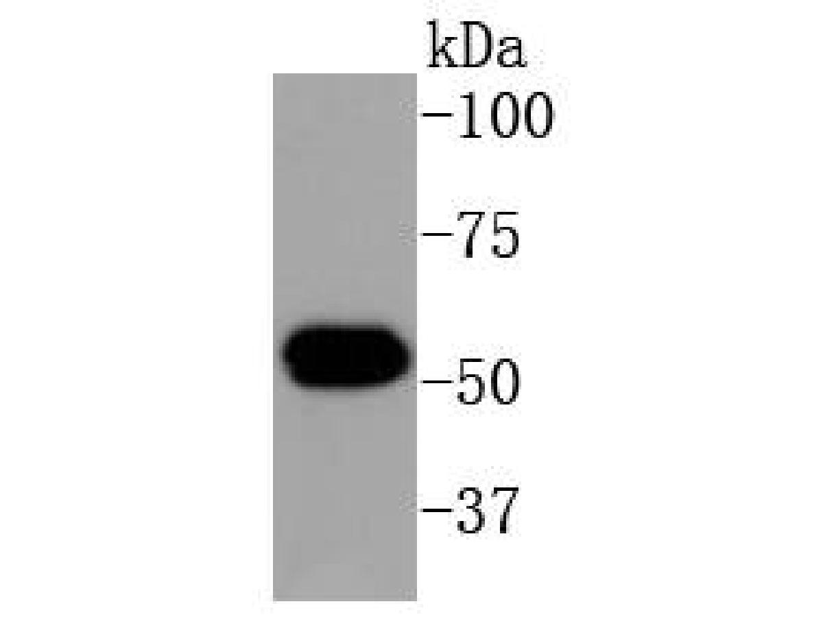 Western blot analysis of Cytokeratin 16 on human skin tissue lysates. Proteins were transferred to a PVDF membrane and blocked with 5% BSA in PBS for 1 hour at room temperature. The primary antibody (ET1610-17, 1/500) was used in 5% BSA at room temperature for 2 hours. Goat Anti-Rabbit IgG - HRP Secondary Antibody (HA1001) at 1:5,000 dilution was used for 1 hour at room temperature.
