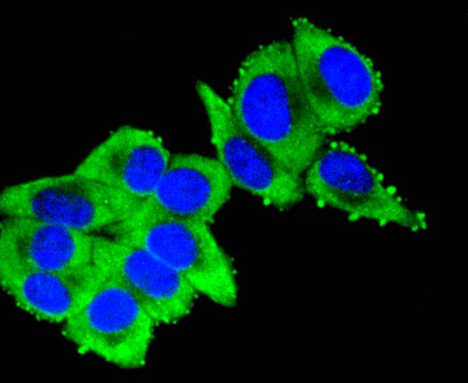 ICC staining of Cytokeratin 16 in HepG2 cells (green). Formalin fixed cells were permeabilized with 0.1% Triton X-100 in TBS for 10 minutes at room temperature and blocked with 1% Blocker BSA for 15 minutes at room temperature. Cells were probed with the primary antibody (ET1610-17, 1/50) for 1 hour at room temperature, washed with PBS. Alexa Fluor®488 Goat anti-Rabbit IgG was used as the secondary antibody at 1/1,000 dilution. The nuclear counter stain is DAPI (blue).