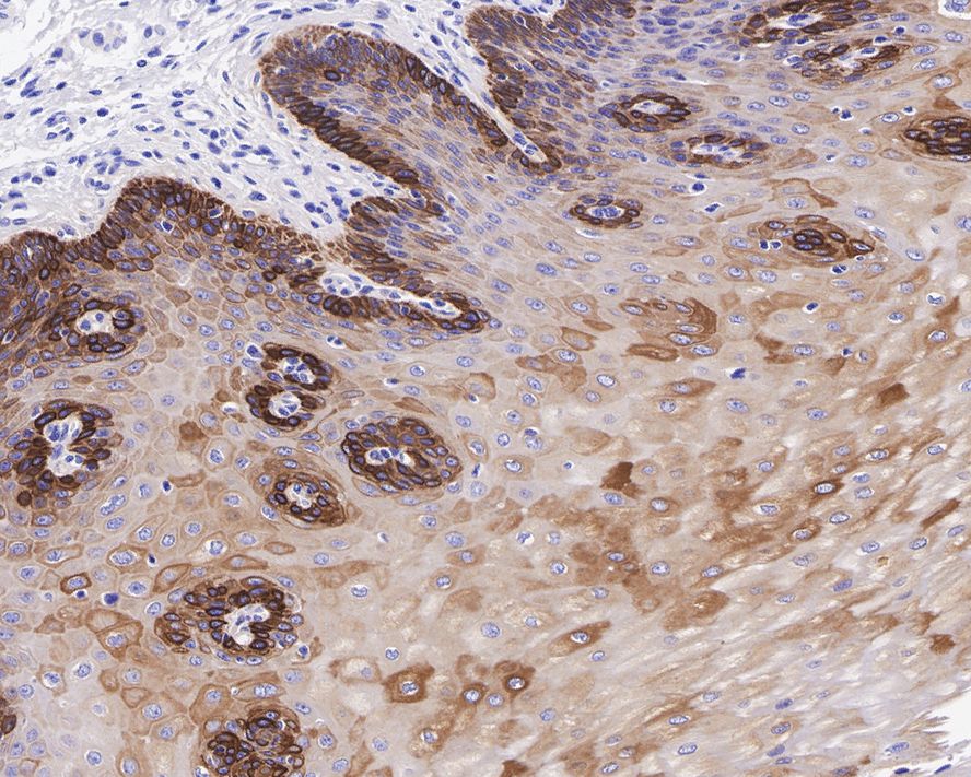 Immunohistochemical analysis of paraffin-embedded human tonsil tissue using anti-Cytokeratin 16 antibody. The section was pre-treated using heat mediated antigen retrieval with Tris-EDTA buffer (pH 8.0-8.4) for 20 minutes.The tissues were blocked in 5% BSA for 30 minutes at room temperature, washed with ddH2O and PBS, and then probed with the primary antibody (ET1610-17, 1/50) for 30 minutes at room temperature. The detection was performed using an HRP conjugated compact polymer system. DAB was used as the chromogen. Tissues were counterstained with hematoxylin and mounted with DPX.