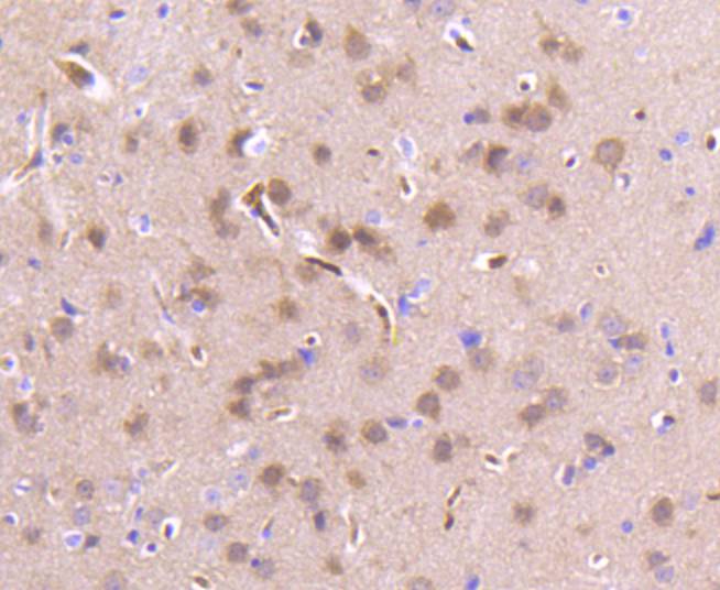 Immunohistochemical analysis of paraffin-embedded mouse brain tissue using anti-PBP antibody. The section was pre-treated using heat mediated antigen retrieval with Tris-EDTA buffer (pH 8.0-8.4) for 20 minutes.The tissues were blocked in 5% BSA for 30 minutes at room temperature, washed with ddH2O and PBS, and then probed with the primary antibody (ET1610-18, 1/50) for 30 minutes at room temperature. The detection was performed using an HRP conjugated compact polymer system. DAB was used as the chromogen. Tissues were counterstained with hematoxylin and mounted with DPX.
