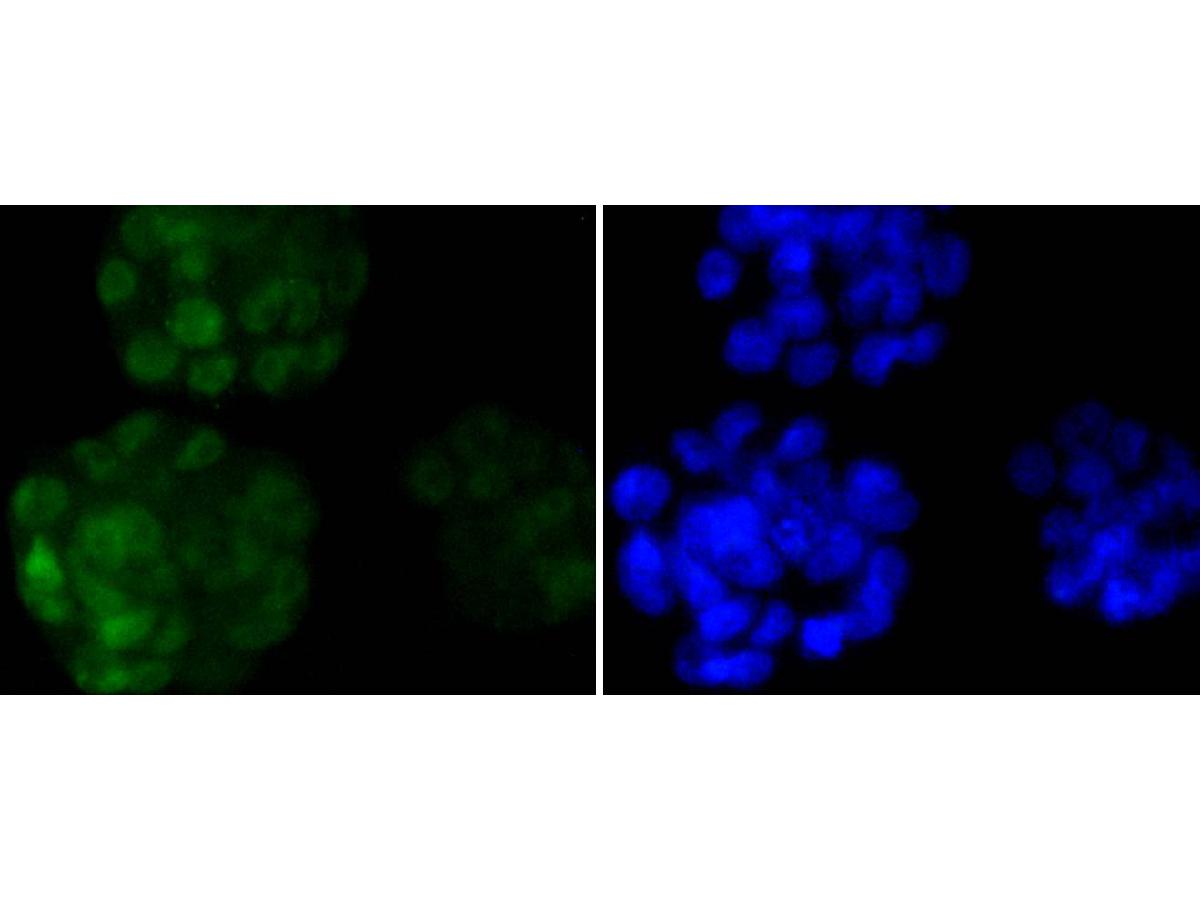 ICC staining of Nanog in F9 cells (green). Formalin fixed cells were permeabilized with 0.1% Triton X-100 in TBS for 10 minutes at room temperature and blocked with 1% Blocker BSA for 15 minutes at room temperature. Cells were probed with the primary antibody (ET1610-2, 1/50) for 1 hour at room temperature, washed with PBS. Alexa Fluor®488 Goat anti-Rabbit IgG was used as the secondary antibody at 1/1,000 dilution. The nuclear counter stain is DAPI (blue).