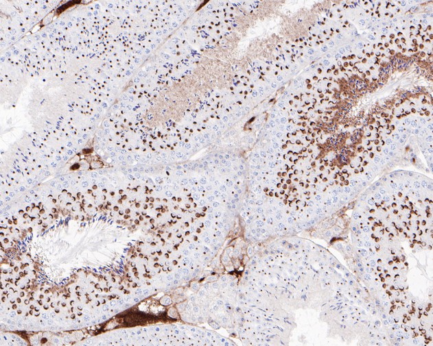 Immunohistochemical analysis of paraffin-embedded mouse testis tissue using anti-Nanog antibody. The section was pre-treated using heat mediated antigen retrieval with sodium citrate buffer (pH 6.0) for 20 minutes. The tissues were blocked in 5% BSA for 30 minutes at room temperature, washed with ddH2O and PBS, and then probed with the primary antibody (ET1610-2, 1/200)  for 30 minutes at room temperature. The detection was performed using an HRP conjugated compact polymer system. DAB was used as the chromogen. Tissues were counterstained with hematoxylin and mounted with DPX.