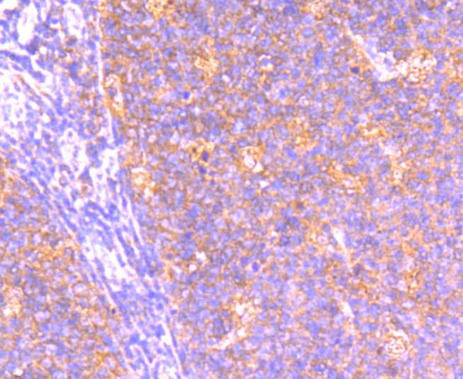 Immunohistochemical analysis of paraffin-embedded human kidney tissue with Rabbit anti-BCL2A1 antibody (ET1610-20) at 1/400 dilution.<br />
<br />
The section was pre-treated using heat mediated antigen retrieval with Tris-EDTA buffer (pH 9.0) for 20 minutes. The tissues were blocked in 1% BSA for 20 minutes at room temperature, washed with ddH2O and PBS, and then probed with the primary antibody (ET1610-20) at 1/400 dilution for 1 hour at room temperature. The detection was performed using an HRP conjugated compact polymer system. DAB was used as the chromogen. Tissues were counterstained with hematoxylin and mounted with DPX.