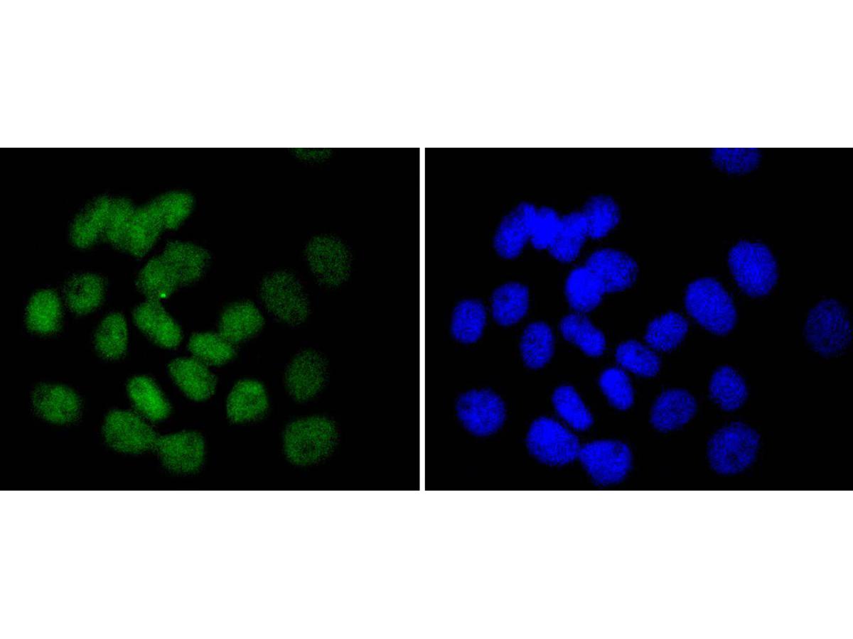 ICC staining of UBC9 in A431 cells (green). Formalin fixed cells were permeabilized with 0.1% Triton X-100 in TBS for 10 minutes at room temperature and blocked with 1% Blocker BSA for 15 minutes at room temperature. Cells were probed with the primary antibody (ET1610-21, 1/50) for 1 hour at room temperature, washed with PBS. Alexa Fluor®488 Goat anti-Rabbit IgG was used as the secondary antibody at 1/1,000 dilution. The nuclear counter stain is DAPI (blue).