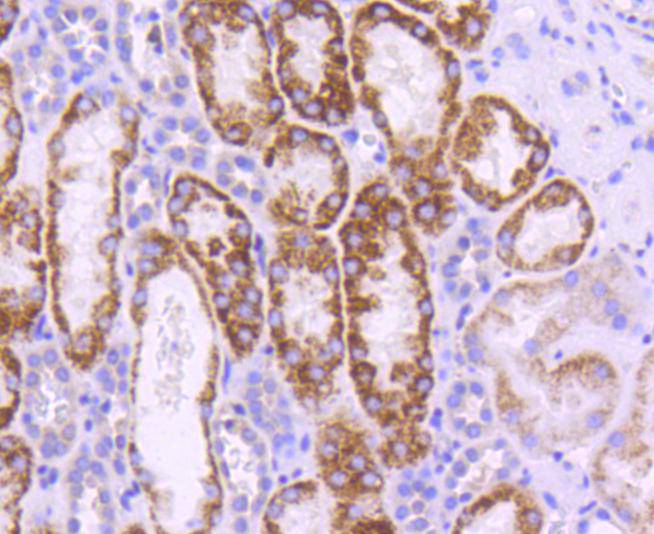 Immunohistochemical analysis of paraffin-embedded human kidney tissue using anti-UBC9 antibody. The section was pre-treated using heat mediated antigen retrieval with Tris-EDTA buffer (pH 8.0-8.4) for 20 minutes.The tissues were blocked in 5% BSA for 30 minutes at room temperature, washed with ddH2O and PBS, and then probed with the primary antibody (ET1610-21, 1/50) for 30 minutes at room temperature. The detection was performed using an HRP conjugated compact polymer system. DAB was used as the chromogen. Tissues were counterstained with hematoxylin and mounted with DPX.