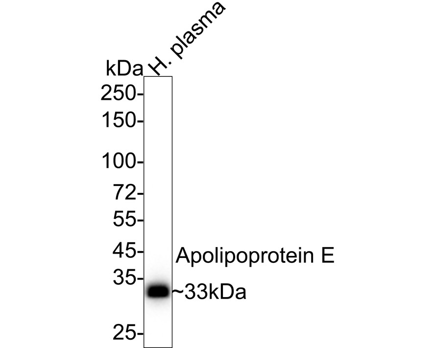 Western blot analysis of Apolipoprotein E on human plasma tissue lysates with Rabbit anti-Apolipoprotein E antibody (ET1610-22) at 1/1,000 dilution.<br />
<br />
Lysates/proteins at 20 µg/Lane.<br />
<br />
Predicted band size: 36 kDa<br />
Observed band size: 33 kDa<br />
<br />
Exposure time: 6 seconds;<br />
<br />
4-20% SDS-PAGE gel.<br />
<br />
Proteins were transferred to a PVDF membrane and blocked with 5% NFDM/TBST for 1 hour at room temperature. The primary antibody (ET1610-22) at 1/1,000 dilution was used in 5% NFDM/TBST at 4℃ overnight. Goat Anti-Rabbit IgG - HRP Secondary Antibody (HA1001) at 1/50,000 dilution was used for 1 hour at room temperature.