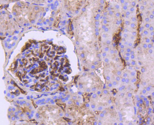 Immunohistochemical analysis of paraffin-embedded human kidney tissue using anti-Apolipoprotein E antibody. The section was pre-treated using heat mediated antigen retrieval with Tris-EDTA buffer (pH 8.0-8.4) for 20 minutes.The tissues were blocked in 5% BSA for 30 minutes at room temperature, washed with ddH2O and PBS, and then probed with the primary antibody (ET1610-22, 1/50) for 30 minutes at room temperature. The detection was performed using an HRP conjugated compact polymer system. DAB was used as the chromogen. Tissues were counterstained with hematoxylin and mounted with DPX.