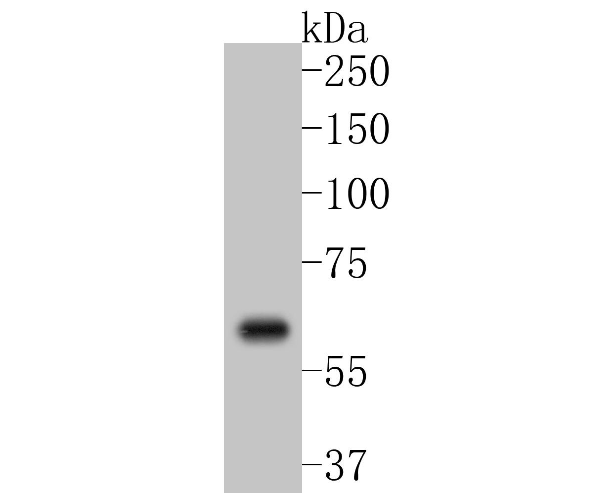 Western blot analysis of COX2/Cyclooxygenase 2 on A549 cell lysates. Proteins were transferred to a PVDF membrane and blocked with 5% BSA in PBS for 1 hour at room temperature. The primary antibody (ET1610-23, 1/500) was used in 5% BSA at room temperature for 2 hours. Goat Anti-Rabbit IgG - HRP Secondary Antibody (HA1001) at 1:5,000 dilution was used for 1 hour at room temperature.