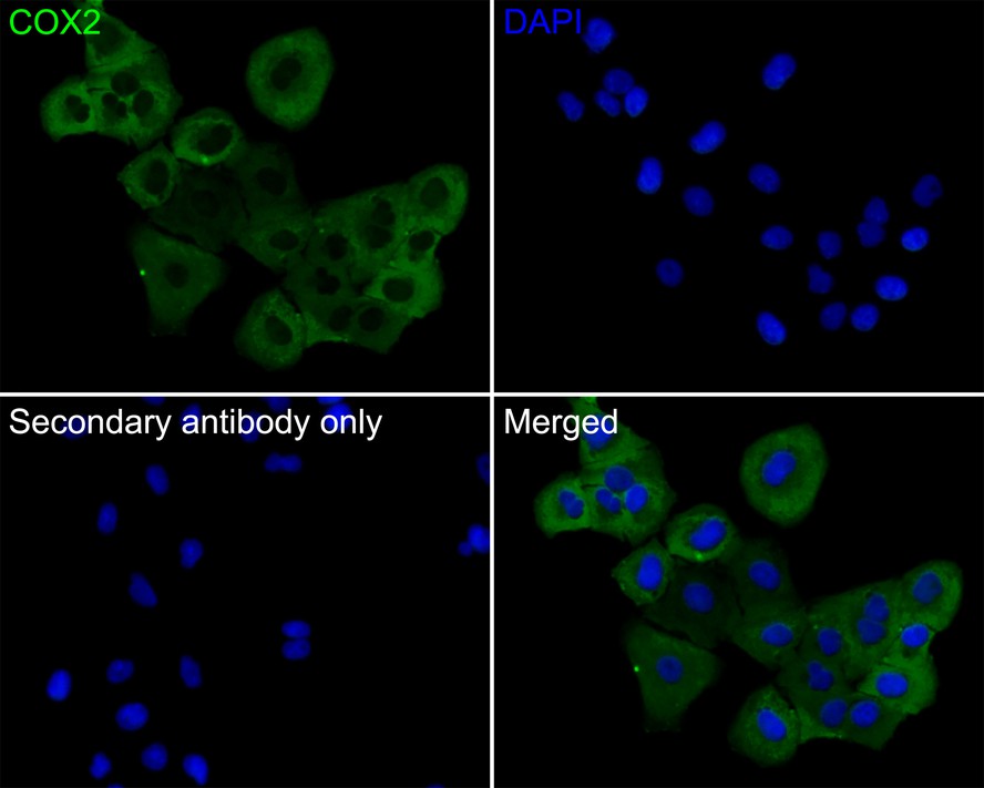 Immunocytochemistry analysis of A549 cells labeling COX2/Cyclooxygenase 2 with Rabbit anti-COX2/Cyclooxygenase 2 antibody (ET1610-23) at 1/50 dilution.<br />
<br />
Cells were fixed in 4% paraformaldehyde for 10 minutes at 37 ℃, permeabilized with 0.05% Triton X-100 in PBS for 20 minutes, and then blocked with 2% negative goat serum for 30 minutes at room temperature. Cells were then incubated with Rabbit anti-COX2/Cyclooxygenase 2 antibody (ET1610-23) at 1/50 dilution in 2% negative goat serum overnight at 4 ℃. Goat Anti-Rabbit IgG H&L (iFluor™ 488, HA1121) was used as the secondary antibody at 1/1,000 dilution. PBS instead of the primary antibody was used as the secondary antibody only control. Nuclear DNA was labelled in blue with DAPI.