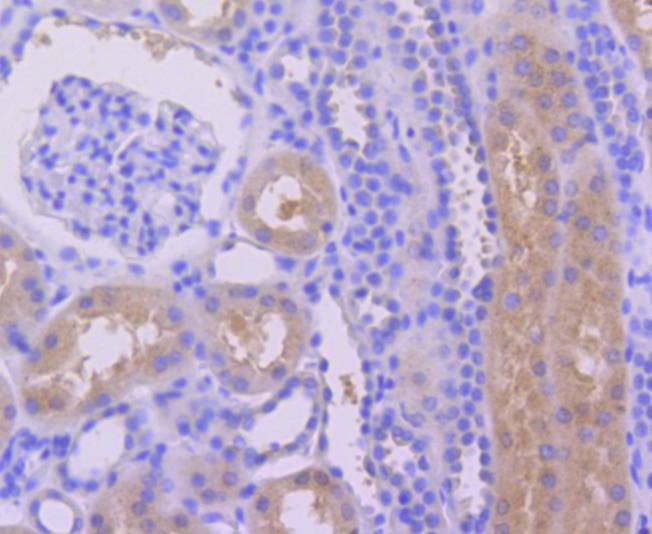 Immunohistochemical analysis of paraffin-embedded human kidney tissue using anti-Caspase-6 antibody. The section was pre-treated using heat mediated antigen retrieval with Tris-EDTA buffer (pH 9.0) for 20 minutes.The tissues were blocked in 1% BSA for 30 minutes at room temperature, washed with ddH2O and PBS, and then probed with the primary antibody (ET1610-24, 1/50) for 30 minutes at room temperature. The detection was performed using an HRP conjugated compact polymer system. DAB was used as the chromogen. Tissues were counterstained with hematoxylin and mounted with DPX.