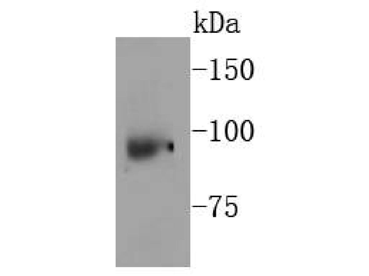 Western blot analysis of p95 NBS1 on human lung tissue lysates. Proteins were transferred to a PVDF membrane and blocked with 5% BSA in PBS for 1 hour at room temperature. The primary antibody (ET1610-26, 1/500) was used in 5% BSA at room temperature for 2 hours. Goat Anti-Rabbit IgG - HRP Secondary Antibody (HA1001) at 1:200,000 dilution was used for 1 hour at room temperature.