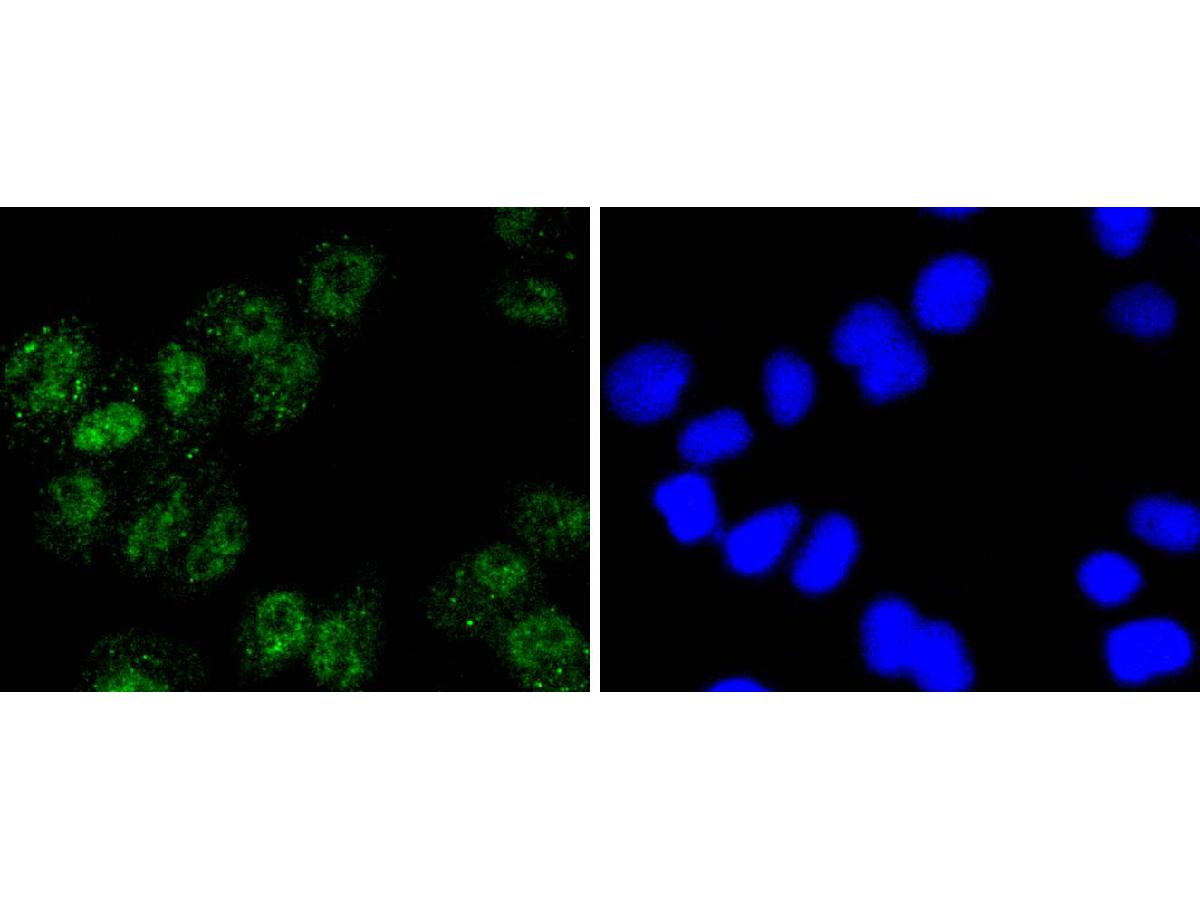 ICC staining of p95 NBS1 in Hela cells (green). Formalin fixed cells were permeabilized with 0.1% Triton X-100 in TBS for 10 minutes at room temperature and blocked with 10% negative goat serum for 15 minutes at room temperature. Cells were probed with the primary antibody (ET1610-26, 1/50) for 1 hour at room temperature, washed with PBS. Alexa Fluor®488 conjugate-Goat anti-Rabbit IgG was used as the secondary antibody at 1/1,000 dilution. The nuclear counter stain is DAPI (blue).