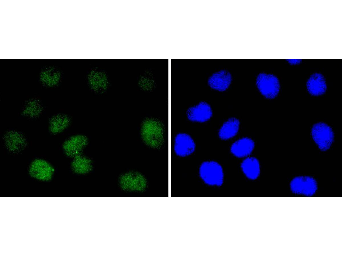 ICC staining of p95 NBS1 in A431 cells (green). Formalin fixed cells were permeabilized with 0.1% Triton X-100 in TBS for 10 minutes at room temperature and blocked with 10% negative goat serum for 15 minutes at room temperature. Cells were probed with the primary antibody (ET1610-26, 1/50) for 1 hour at room temperature, washed with PBS. Alexa Fluor®488 conjugate-Goat anti-Rabbit IgG was used as the secondary antibody at 1/1,000 dilution. The nuclear counter stain is DAPI (blue).