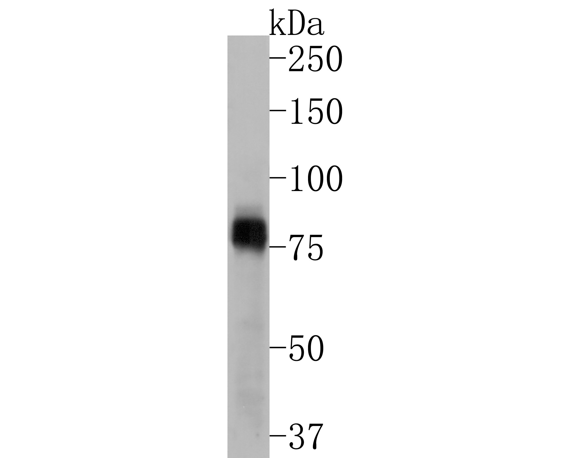 Western blot analysis of Phospho-RSK1(S380) on A431 cell lysates. Proteins were transferred to a PVDF membrane and blocked with 5% BSA in PBS for 1 hour at room temperature. The primary antibody (ET1610-28, 1/500) was used in 5% BSA at room temperature for 2 hours. Goat Anti-Rabbit IgG - HRP Secondary Antibody (HA1001) at 1:200,000 dilution was used for 1 hour at room temperature.<br />
<br />
Predicted band size: 83 kDa<br />
Observed band size: 80 kDa