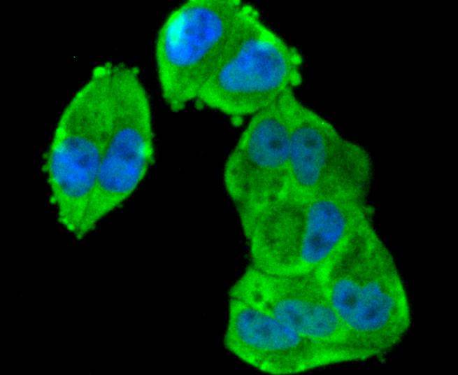 ICC staining of Phospho-RSK1(S380) in Hela cells (green). Formalin fixed cells were permeabilized with 0.1% Triton X-100 in TBS for 10 minutes at room temperature and blocked with 10% negative goat serum for 15 minutes at room temperature. Cells were probed with the primary antibody (ET1610-28, 1/50) for 1 hour at room temperature, washed with PBS. Alexa Fluor®488 conjugate-Goat anti-Rabbit IgG was used as the secondary antibody at 1/1,000 dilution. The nuclear counter stain is DAPI (blue).