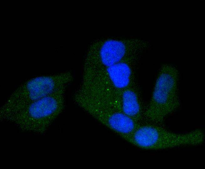 ICC staining of Phospho-PKA R2 (S99) in Hela cells (green). Formalin fixed cells were permeabilized with 0.1% Triton X-100 in TBS for 10 minutes at room temperature and blocked with 1% Blocker BSA for 15 minutes at room temperature. Cells were probed with the primary antibody (ET1610-29, 1/50) for 1 hour at room temperature, washed with PBS. Alexa Fluor®488 Goat anti-Rabbit IgG was used as the secondary antibody at 1/1,000 dilution. The nuclear counter stain is DAPI (blue).