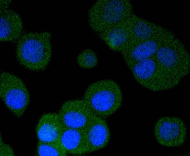 ICC staining of Phospho-PKA R2 (S99) in MCF-7 cells (green). Formalin fixed cells were permeabilized with 0.1% Triton X-100 in TBS for 10 minutes at room temperature and blocked with 1% Blocker BSA for 15 minutes at room temperature. Cells were probed with the primary antibody (ET1610-29, 1/50) for 1 hour at room temperature, washed with PBS. Alexa Fluor®488 Goat anti-Rabbit IgG was used as the secondary antibody at 1/1,000 dilution. The nuclear counter stain is DAPI (blue).