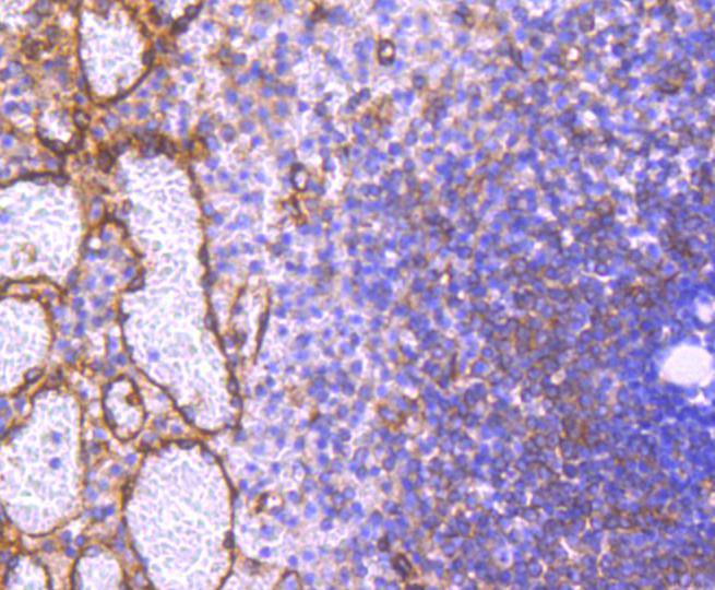 Immunohistochemical analysis of paraffin-embedded human spleen tissue using anti-Phospho-PKA R2 (S99) antibody. The section was pre-treated using heat mediated antigen retrieval with Tris-EDTA buffer (pH 8.0-8.4) for 20 minutes.The tissues were blocked in 5% BSA for 30 minutes at room temperature, washed with ddH2O and PBS, and then probed with the primary antibody (ET1610-29, 1/50) for 30 minutes at room temperature. The detection was performed using an HRP conjugated compact polymer system. DAB was used as the chromogen. Tissues were counterstained with hematoxylin and mounted with DPX.