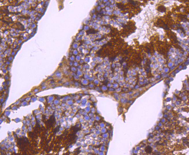 Immunohistochemical analysis of paraffin-embedded mouse testis tissue using anti-Phospho-PKA R2 (S99) antibody. The section was pre-treated using heat mediated antigen retrieval with Tris-EDTA buffer (pH 8.0-8.4) for 20 minutes.The tissues were blocked in 5% BSA for 30 minutes at room temperature, washed with ddH2O and PBS, and then probed with the primary antibody (ET1610-29, 1/50) for 30 minutes at room temperature. The detection was performed using an HRP conjugated compact polymer system. DAB was used as the chromogen. Tissues were counterstained with hematoxylin and mounted with DPX.