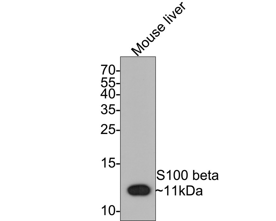 Western blot analysis of S100 beta on mouse liver tissue lysates with Rabbit anti-S100 beta antibody (ET1610-3) at 1/1,000 dilution.<br />
<br />
Lysates/proteins at 20 µg/Lane.<br />
<br />
Predicted band size: 11 kDa<br />
Observed band size: 11 kDa<br />
<br />
Exposure time: 2 minutes;<br />
<br />
15% SDS-PAGE gel.<br />
<br />
Proteins were transferred to a PVDF membrane and blocked with 5% NFDM/TBST for 1 hour at room temperature. The primary antibody (ET1610-3) at 1/1,000 dilution was used in 5% NFDM/TBST at room temperature for 2 hours. Goat Anti-Rabbit IgG - HRP Secondary Antibody (HA1001) at 1:300,000 dilution was used for 1 hour at room temperature.