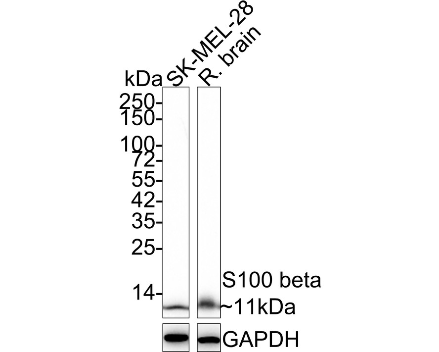 Western blot analysis of S100 beta on different lysates with Rabbit anti-S100 beta antibody (ET1610-3) at 1/2,000 dilution.<br />
<br />
Lane 1: SK-MEL-28 cell lysate (15 µg/Lane)<br />
Lane 2: Rat brain tissue lysate (20 µg/Lane)<br />
<br />
Predicted band size: 11 kDa<br />
Observed band size: 11 kDa<br />
<br />
Exposure time: 3 minutes 10 seconds;<br />
<br />
4-20% SDS-PAGE gel.<br />
<br />
Proteins were transferred to a PVDF membrane and blocked with 5% NFDM/TBST for 1 hour at room temperature. The primary antibody (ET1610-3) at 1/2,000 dilution was used in 5% NFDM/TBST at 4℃ overnight. Goat Anti-Rabbit IgG - HRP Secondary Antibody (HA1001) at 1:50,000 dilution was used for 1 hour at room temperature.