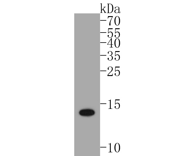 Western blot analysis of S100 beta on zebrafish tissue lysates. Proteins were transferred to a PVDF membrane and blocked with 5% BSA in PBS for 1 hour at room temperature. The primary antibody (ET1610-3, 1/500) was used in 5% BSA at room temperature for 2 hours. Goat Anti-Rabbit IgG - HRP Secondary Antibody (HA1001) at 1:5,000 dilution was used for 1 hour at room temperature.<br />
<br />
Predicted band size: 11 kDa<br />
Observed band size: 14 kDa