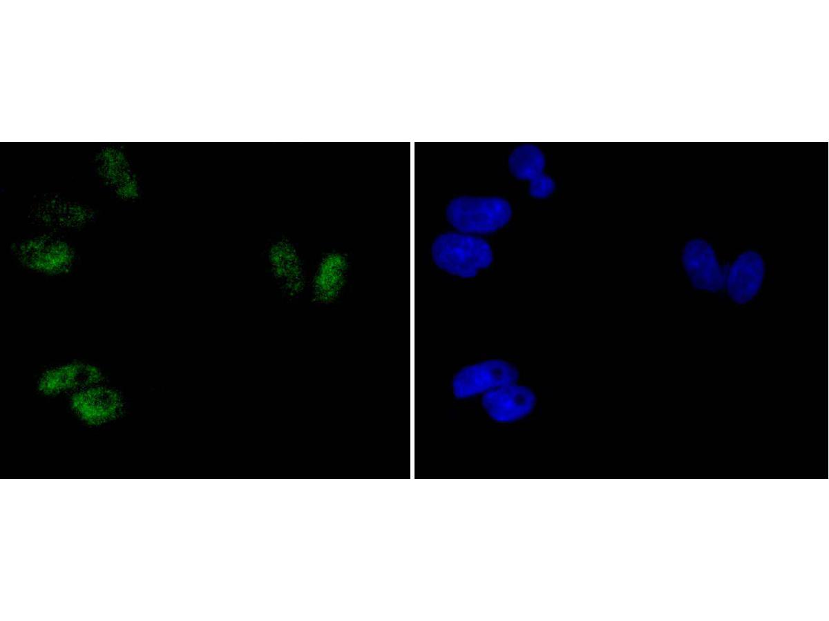 ICC staining of Phospho-ATF2(T71) in Hela cells (green). Formalin fixed cells were permeabilized with 0.1% Triton X-100 in TBS for 10 minutes at room temperature and blocked with 1% Blocker BSA for 15 minutes at room temperature. Cells were probed with the primary antibody (ET1610-30, 1/50) for 1 hour at room temperature, washed with PBS. Alexa Fluor®488 Goat anti-Rabbit IgG was used as the secondary antibody at 1/1,000 dilution. The nuclear counter stain is DAPI (blue).