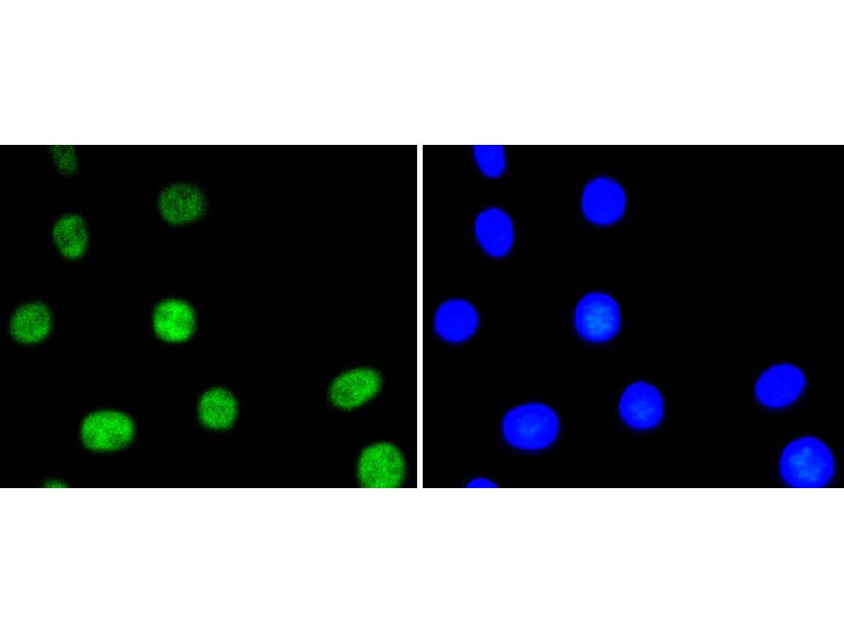 ICC staining of Phospho-ATF2(T71) in NIH/3T3 cells (green). Formalin fixed cells were permeabilized with 0.1% Triton X-100 in TBS for 10 minutes at room temperature and blocked with 1% Blocker BSA for 15 minutes at room temperature. Cells were probed with the primary antibody (ET1610-30, 1/50) for 1 hour at room temperature, washed with PBS. Alexa Fluor®488 Goat anti-Rabbit IgG was used as the secondary antibody at 1/1,000 dilution. The nuclear counter stain is DAPI (blue).