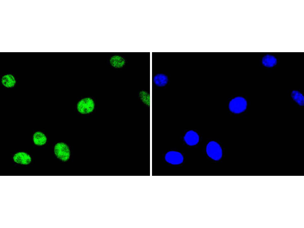 ICC staining of Phospho-ATF2(T71) in SH-SY5Y cells (green). Formalin fixed cells were permeabilized with 0.1% Triton X-100 in TBS for 10 minutes at room temperature and blocked with 1% Blocker BSA for 15 minutes at room temperature. Cells were probed with the primary antibody (ET1610-30, 1/50) for 1 hour at room temperature, washed with PBS. Alexa Fluor®488 Goat anti-Rabbit IgG was used as the secondary antibody at 1/1,000 dilution. The nuclear counter stain is DAPI (blue).