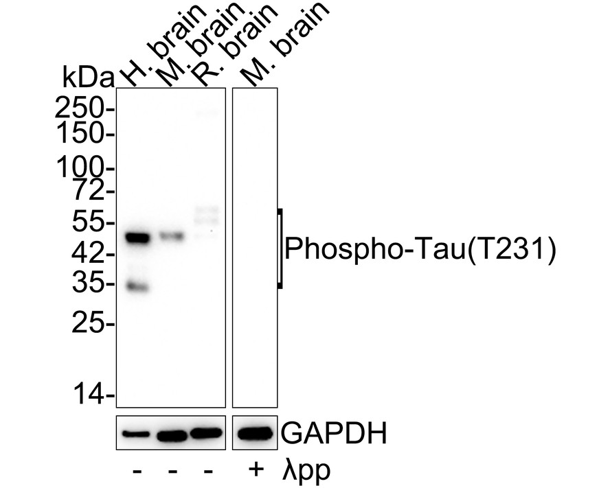 Western blot analysis of Phospho-Tau(T231) on different lysates with Rabbit anti-Phospho-Tau(T231) antibody (ET1610-31) at 1/2,000 dilution.<br />
<br />
Lane 1: Human brain tissue lysate<br />
Lane 2: Mouse brain tissue lysate<br />
Lane 3: Rat brain tissue lysate<br />
Lane 4: Mouse brain treated with λpp for 1 hour tissue lysate<br />
<br />
Lysates/proteins at 20 µg/Lane.<br />
<br />
Predicted band size: 46 kDa<br />
Observed band size: 35-70 kDa<br />
<br />
Exposure time: 3 minutes;<br />
<br />
4-20% SDS-PAGE gel.<br />
<br />
Proteins were transferred to a PVDF membrane and blocked with 5% NFDM/TBST for 1 hour at room temperature. The primary antibody (ET1610-31) at 1/2,000 dilution was used in 5% NFDM/TBST at 4℃ overnight. Goat Anti-Rabbit IgG - HRP Secondary Antibody (HA1001) at 1/50,000 dilution was used for 1 hour at room temperature.