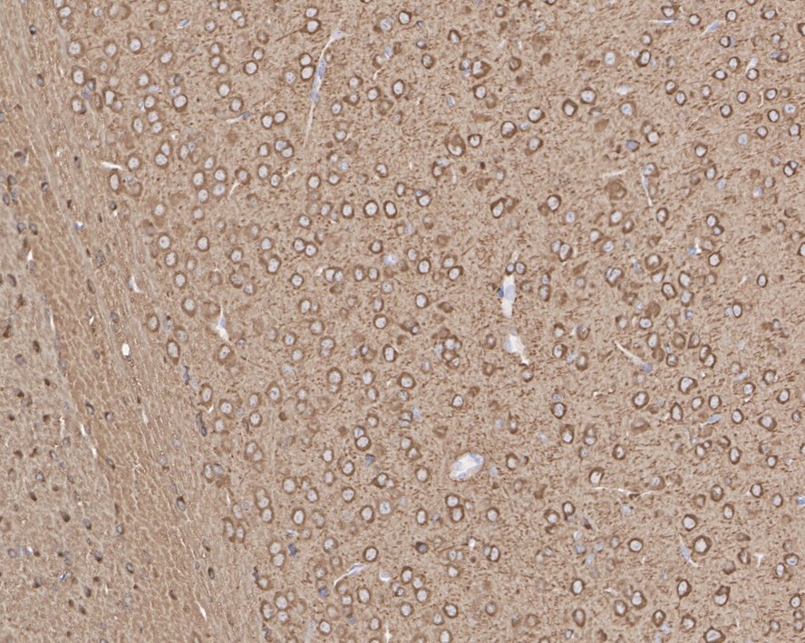 Immunohistochemical analysis of paraffin-embedded mouse brain tissue with Rabbit anti-Phospho-Tau(T231) antibody (ET1610-31) at 1/200 dilution.<br />
<br />
The section was pre-treated using heat mediated antigen retrieval with Tris-EDTA buffer (pH 9.0) for 20 minutes. The tissues were blocked in 1% BSA for 20 minutes at room temperature, washed with ddH2O and PBS, and then probed with the primary antibody (ET1610-31) at 1/200 dilution for 1 hour at room temperature. The detection was performed using an HRP conjugated compact polymer system. DAB was used as the chromogen. Tissues were counterstained with hematoxylin and mounted with DPX.