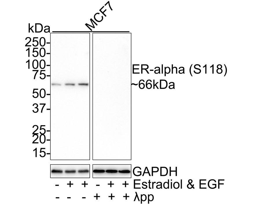 Western blot analysis of Phospho-Estrogen Receptor alpha(S118) on different lysates with Rabbit anti-Phospho-Estrogen Receptor alpha(S118) antibody (ET1610-32) at 1/1,000 dilution.<br />
<br />
Lane 1: MCF7 whole cell lysate<br />
Lane 2: MCF7 treated with 100nM Estradiol for 30 minutes add 100ng/ml EGF for 5 minutes whole cell lysate<br />
Lane 3: MCF7 treated with 100nM Estradiol for 30 minutes then treated with 100ng/ml EGF for 5 minutes whole cell lysate<br />
Lane 4: MCF7 whole cell lysate treated with λpp for 1 hour<br />
Lane 5: MCF7 treated with 100nM Estradiol for 30 minutes add 100ng/ml EGF for 5 minutes whole cell lysate treated with λpp for 1 hour<br />
Lane 6: MCF7 treated with 100nM Estradiol for 30 minutes then treated with 100ng/ml EGF for 5 minutes whole cell lysate treated with λpp for 1 hour<br />
<br />
Lysates/proteins at 20 µg/Lane.<br />
<br />
Predicted band size: 66 kDa<br />
Observed band size: 66 kDa<br />
<br />
Exposure time: 3 minutes;<br />
<br />
4-20% SDS-PAGE gel.<br />
<br />
Proteins were transferred to a PVDF membrane and blocked with 5% NFDM/TBST for 1 hour at room temperature. The primary antibody (ET1610-32) at 1/1,000 dilution was used in 5% NFDM/TBST at room temperature for 2 hours. Goat Anti-Rabbit IgG - HRP Secondary Antibody (HA1001) at 1:100,000 dilution was used for 1 hour at room temperature.